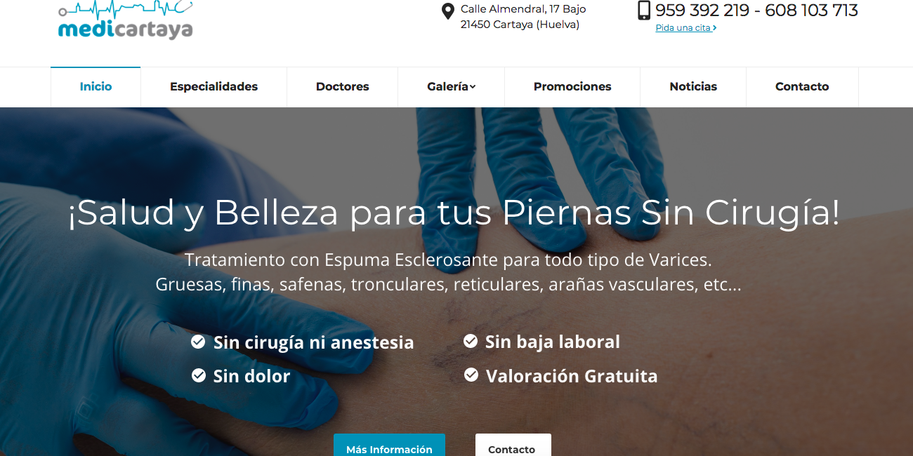 Escleroterapia de varices Nueva Web Medicartaya