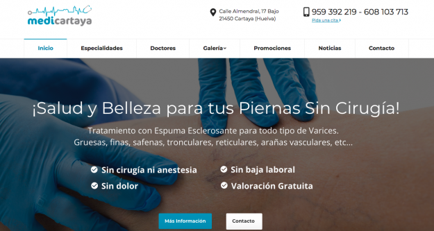 Escleroterapia de varices Nueva Web Medicartaya